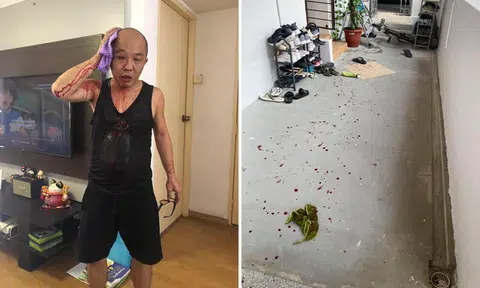Man, 65, arrested for allegedly hitting his neighbour with bicycle chain in Ang Mo Kio