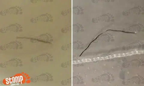 Man vomits blood after metal gets stuck at his throat while eating at Chinatown Point