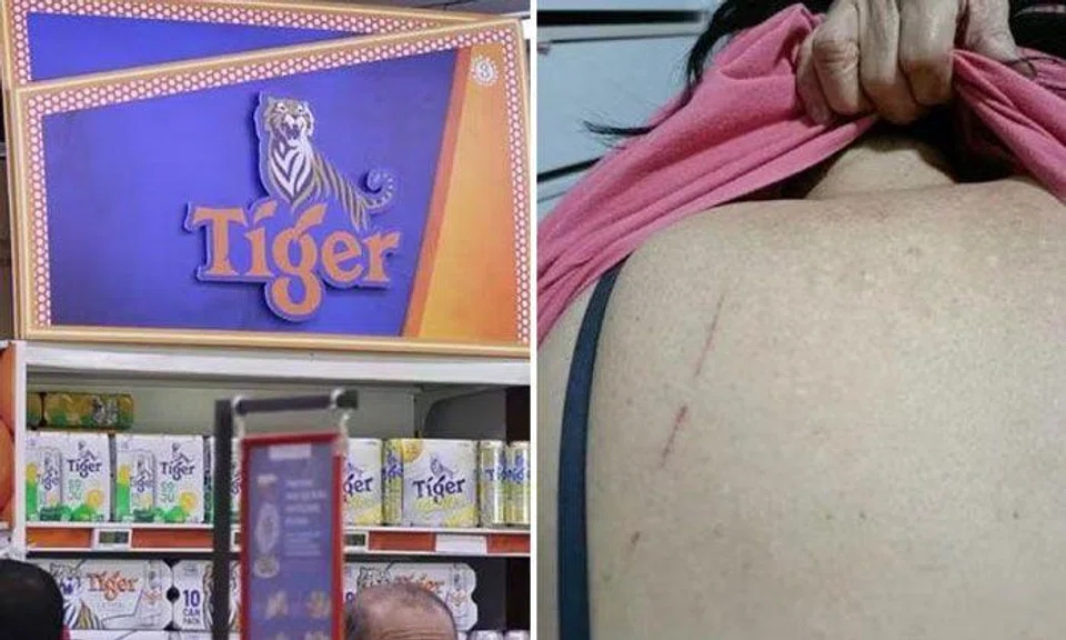 An advertising board promoting a beer brand (left) fell at NTUC FairPrice in Woodlands 888 Plaza, striking a 68-year-old woman’s back (right). The incident tore her clothing and left scratches on her skin. PHOTOS: LIANHE ZAOBAO