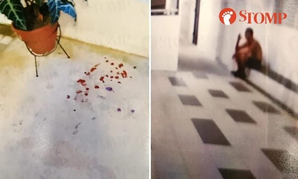 Man, 72, investigated for voluntarily causing hurt.