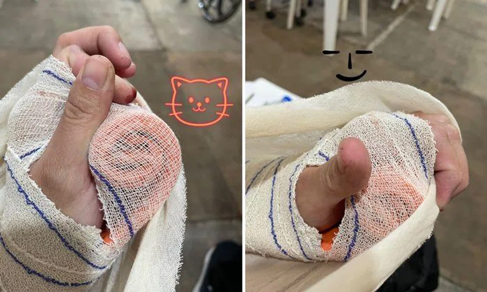 Cyclist Elaine Liew said she sprained her arm and had abrasions on her face and chin. Photos: Facebook/Elaine Liew