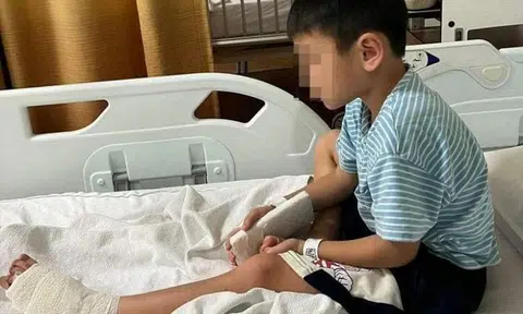 Boy's Crocs-clad foot gets caught in escalator at MRT station: His last toe was dangling