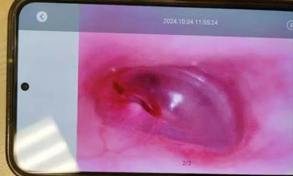 Meridian Sec School student's eardrum ruptured after bullies allegedly hit her for 20 min