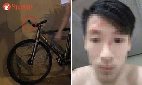 Appeal for witnesses: Cyclist wakes up along Tampines Ave 10 with injuries to face and no recollection of what happened