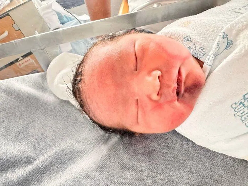"Shortly after birth, a nurse noted red marks on the baby’s face, which by evening had turned into bruises." 