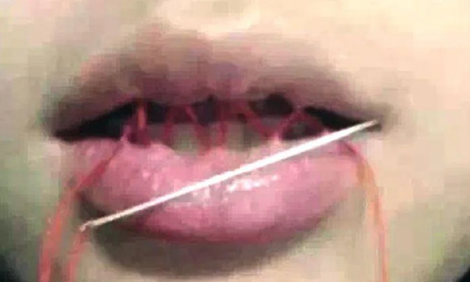 Teens sew their lips and limbs in disturbing "human embroidery" game