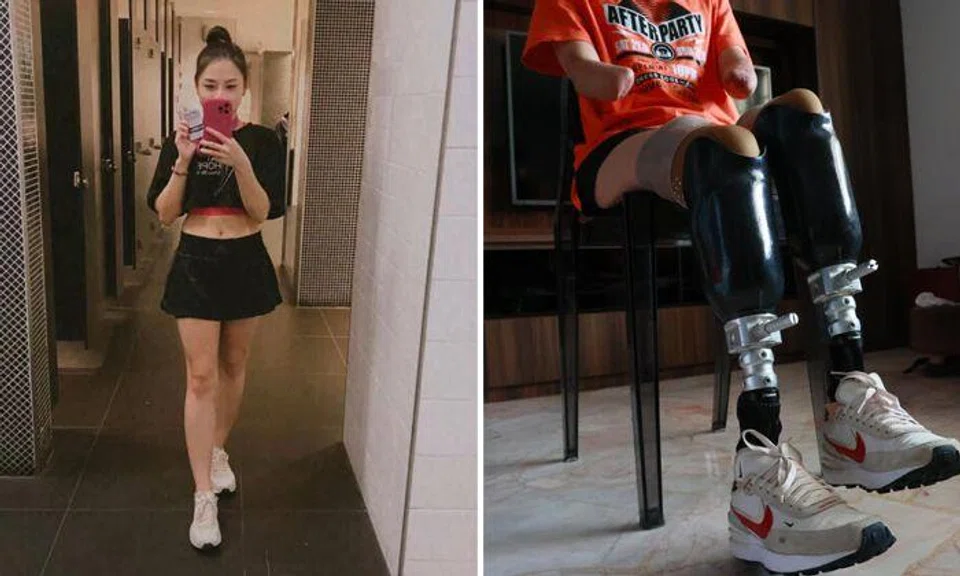 Beautician's limbs amputated due to sepsis: 'I watched my hands and feet turn black'