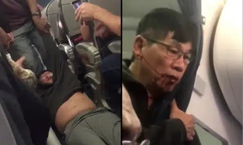 Man dragged off United Airlines flight breaks silence
