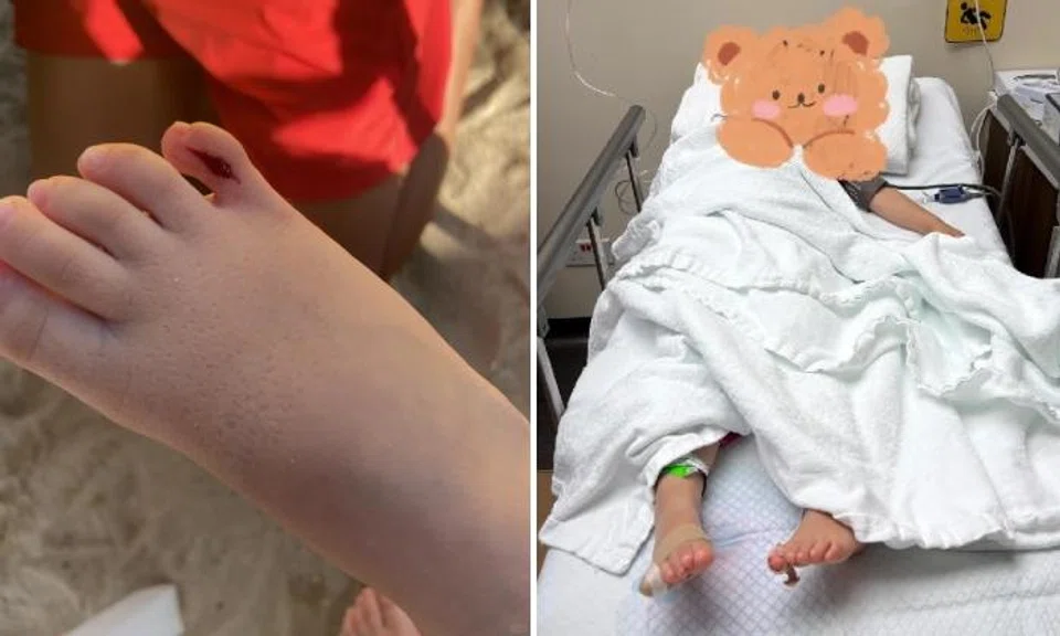 Tourist gets $1,252 medical bill after daughter cuts toe at Sentosa beach club