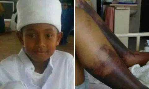 Boy, 11, dies after beating from school warden in Malaysia and going into coma