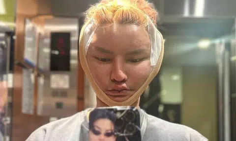 S'porean man insists on finishing $2,400 facelift during Bangkok earthquake before evacuating