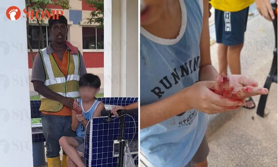 boy's fingertip sliced off after using swing in bishan