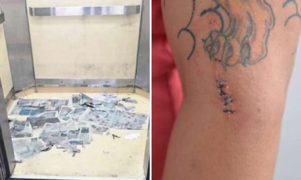 Man's ex-GF stabs him in AMK lift -- after they broke up just a few days earlier