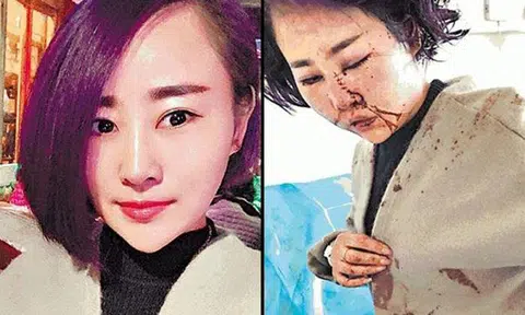 Inhumane thugs assault and disfigure tourist in China -- then taunt her to call the cops after attack