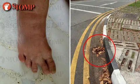 66-year-old woman fractures foot after falling into drain along Bedok Reservoir Road