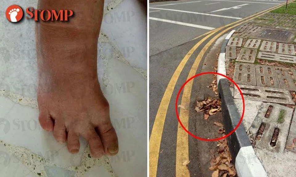 66-year-old woman fractures foot after falling into drain along Bedok Reservoir Road