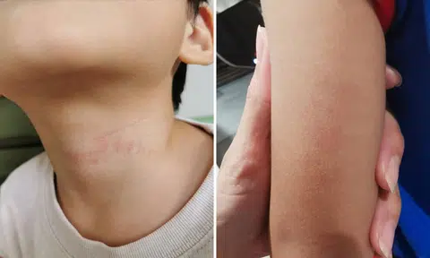 ECDA: Police investigating alleged abuse of 3-year-old boy by Bedok Reservoir preschool teacher