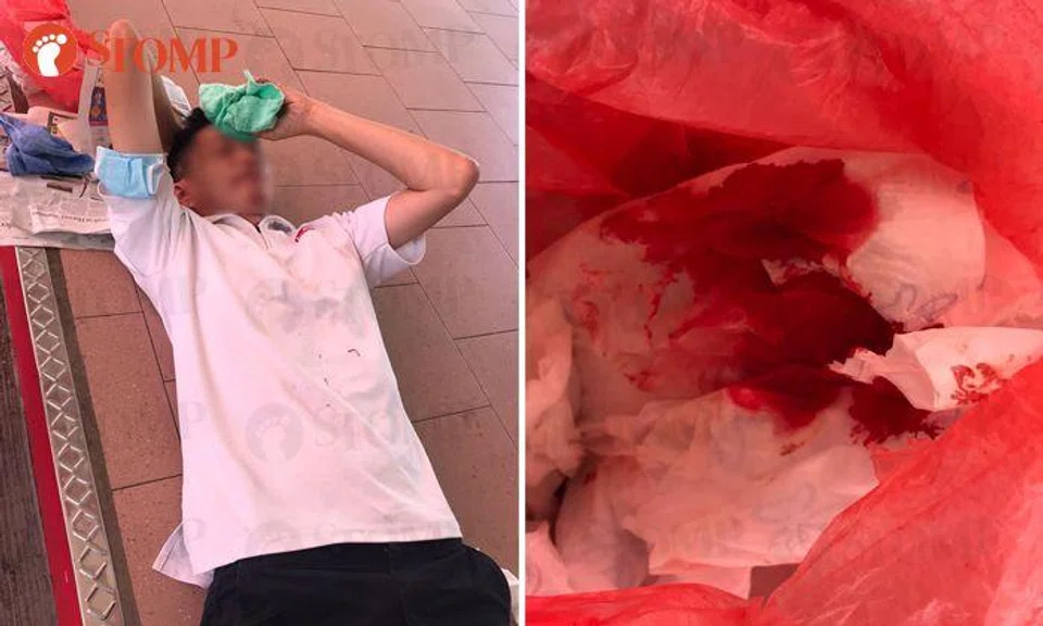 Good Samaritan rushes to get ice and towel for man bleeding at Chong Pang hawker centre