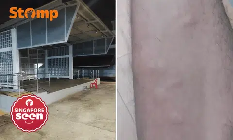 Foldable bed at Ang Mo Kio function stage leaves resident with bed bug bites