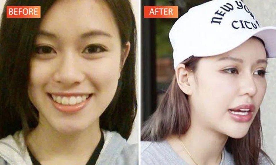 She was already pretty, but YouTube star had plastic surgery over 30 times for BF -- and now regrets it