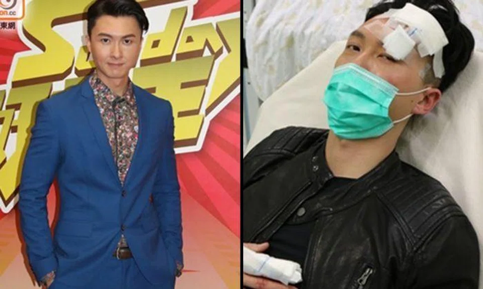 Vincent Wong recounts panic attacks and being unable to speak after botched car chase scene