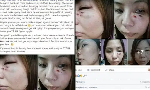 Woman claims ex-BF beat her and slashed her with knife during argument, posts photos of injuries on Facebook