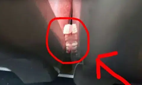 Did anyone lose a set of fake teeth? Dentures was caught in between bus seats