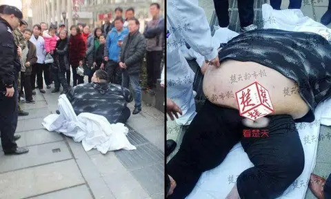 220kg Chinese man falls down on sidewalk, 20 people slog to lift him onto hospital bed