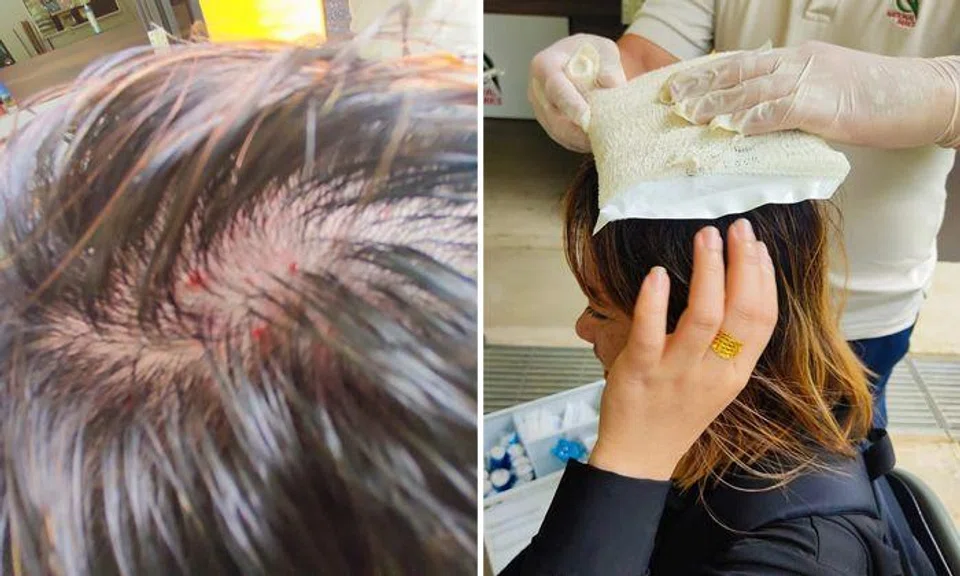 Durian splits open after falling on woman's head at Pulau Ubin