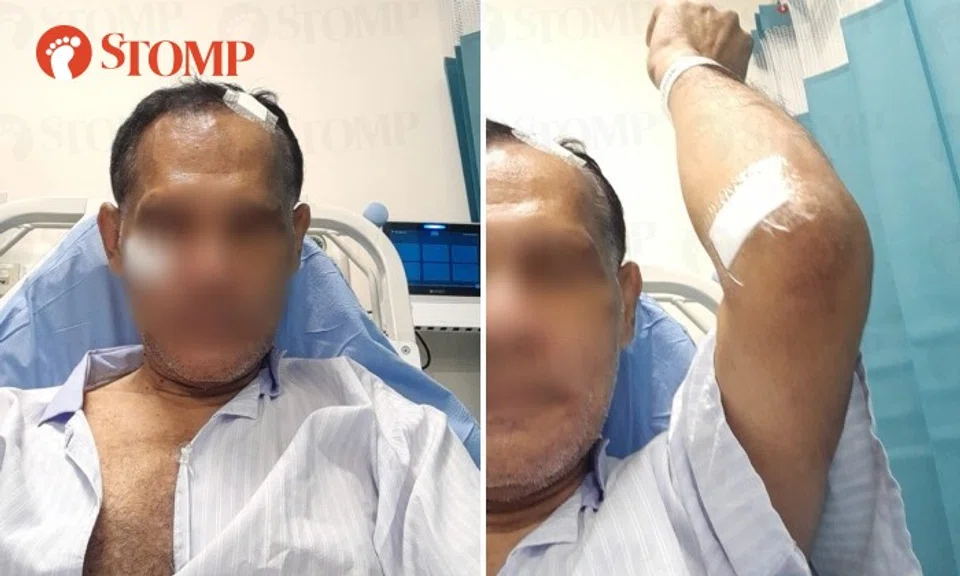 He had injuries on his head, face, eye and arm.