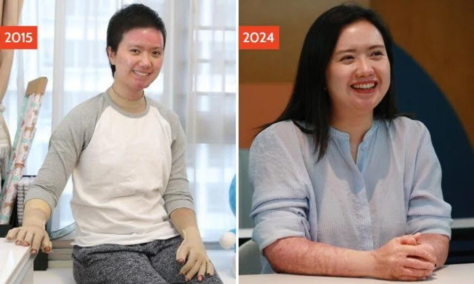 Ms Loy, who was an 18-year-old student at the time, suffered severe burns to 80 per cent of her body. Photo: Lianhe Wanbao, Shin Min Daily News