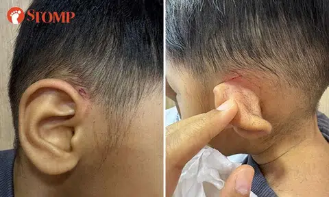 3-year-old boy suffers cuts on ears at Tampines barber shop