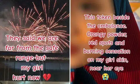 Girl allegedly suffers first-degree burn on her face from National Day fireworks display