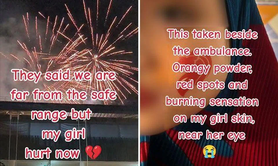 Girl allegedly suffers first-degree burn on her face from National Day fireworks display
