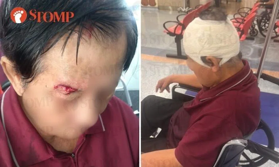 Commuter falls out of wheelchair when bus makes turn, hits head and splits eyelid