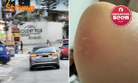 S'pore car allegedly hits woman's elbow in JB and drives off, she chases and confronts driver