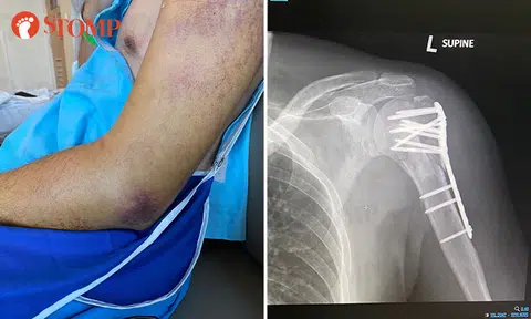 Another injury at Bouncy Paradise: Man breaks arm after jumping onto inflatable mat