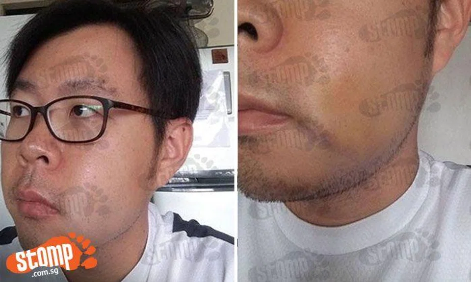 Man left unconscious and suffers concussion after teen banged into him at Hillview MRT Station