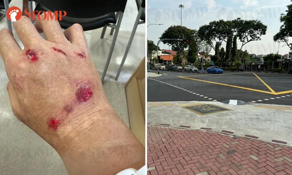 injured by hump