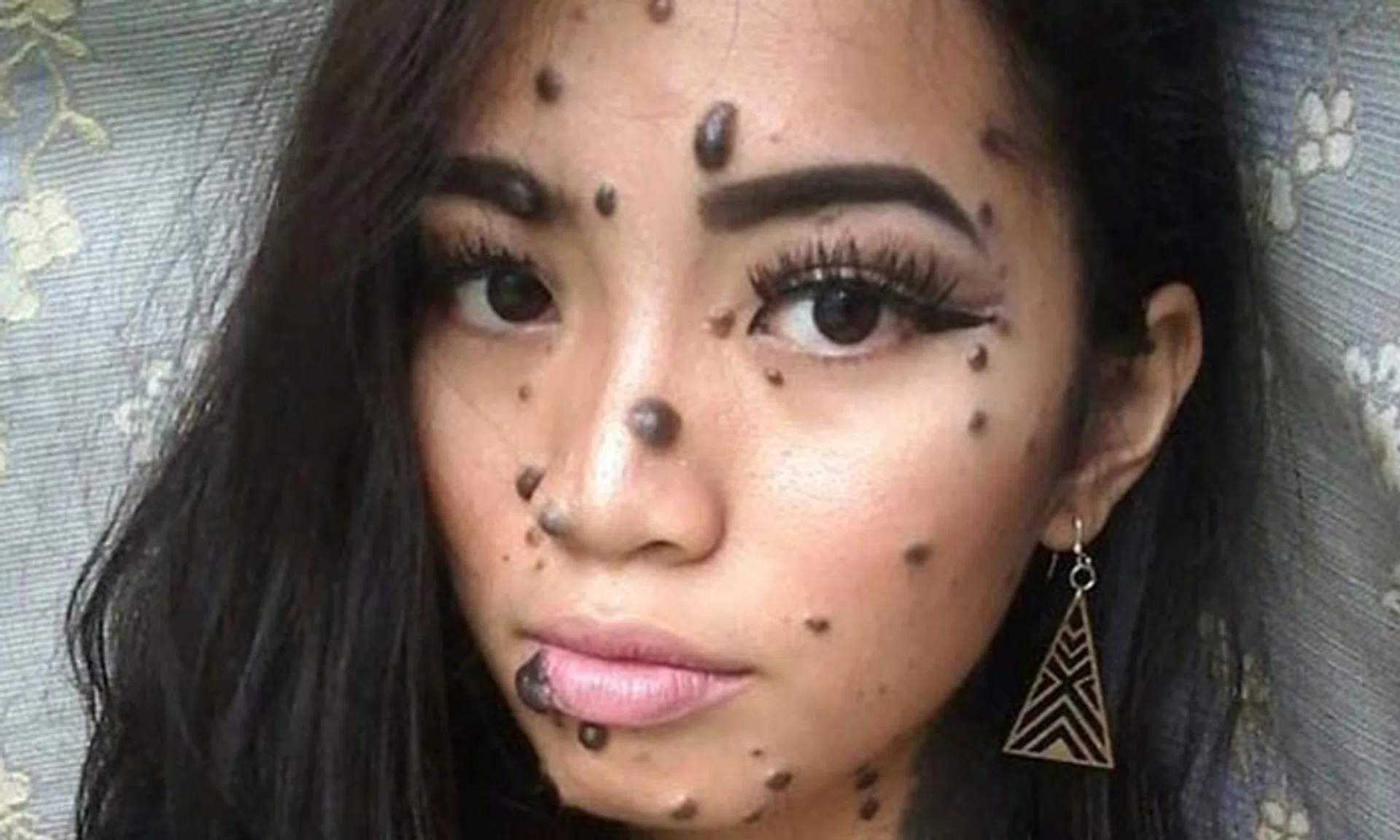 Malaysian girl who was bullied for having moles all over body auditions