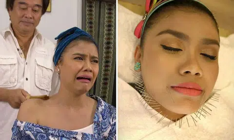 'Face-slapping', 'vampire facial' and other beauty bizarre beauty treatments you don't know about