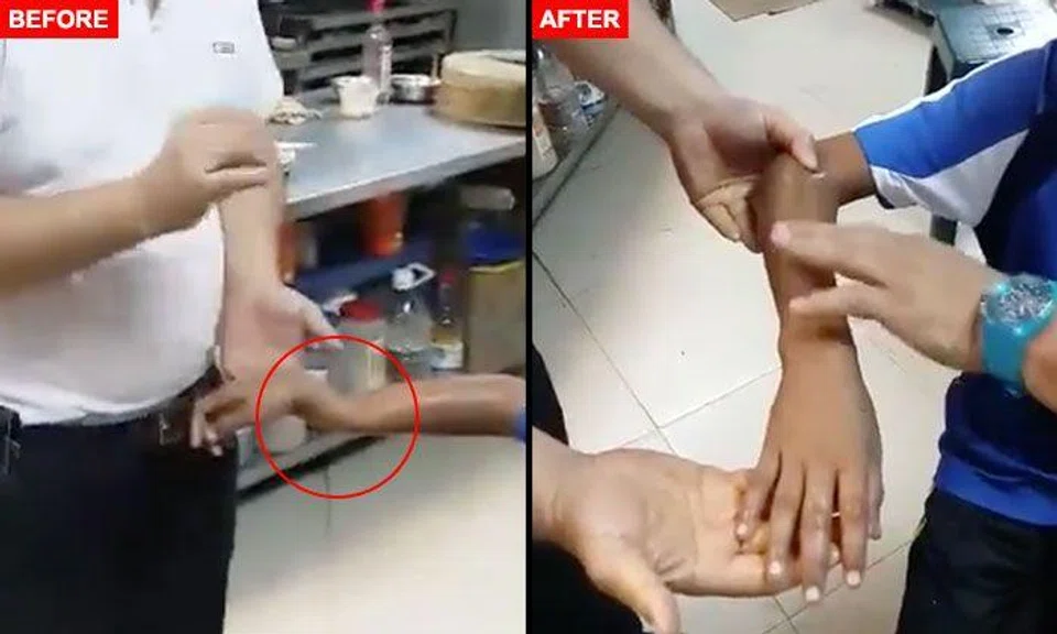 TCM practitioner miraculously fixes boy's bent arm within minutes