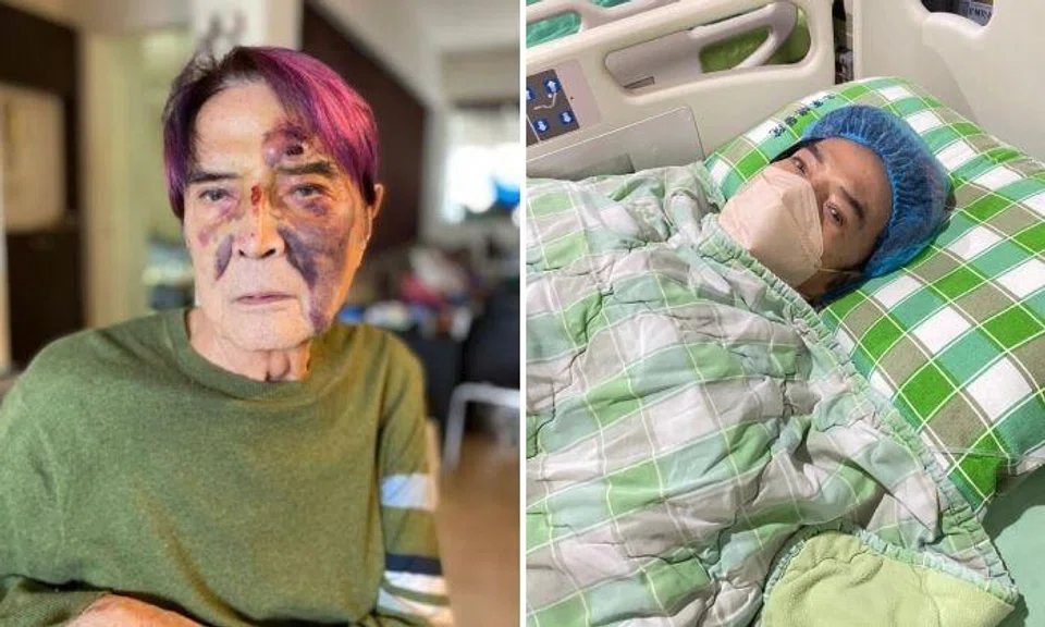 Taiwanese singer Lin Chong, 91, is recovering in hospital after a nasty fall at home left him with a fractured hip.