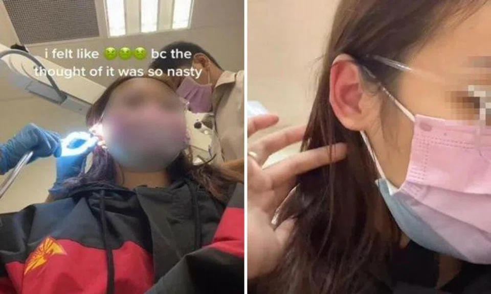 Cockroach wiggles into woman's ear, breaks in pieces as she tries to pluck it out