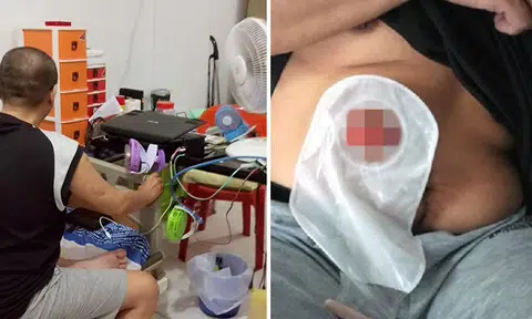 Stroke patient struggles with cancer for 13 years, makes a living by fixing appliances