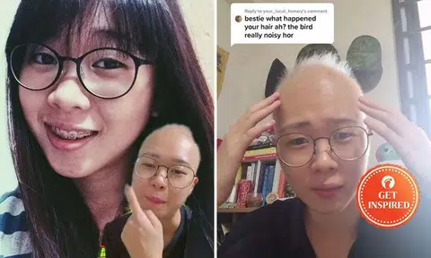 Singapore girl wins over TikTok by sharing her experiences and struggles with alopecia