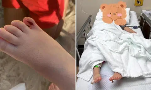 Tourist gets $1,252 medical bill after daughter cuts toe at Sentosa beach club and ends up in hospital