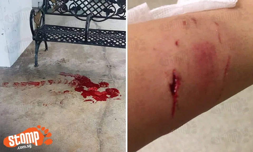 Injuries caused by monkey attacks at Segar Road