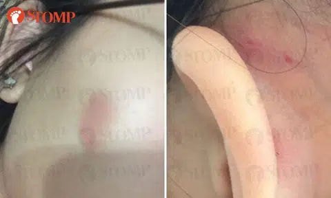 'Senior supervisor' at CCK pub allegedly slaps patron 3 times -- after she asks for more time to finish drinks