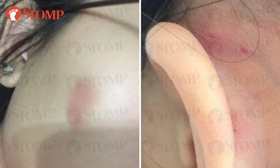 'Senior supervisor' at CCK pub allegedly slaps patron 3 times -- after she asks for more time to finish drinks